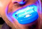 Tanden-Whitening-Draagbare-Mini-Led-Blauw-Licht-Smart-Whitener-Instrument-Tanden-Bleken-Schoon...jpg